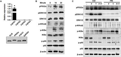 Disruption of FGF Signaling Ameliorates Inflammatory Response in Hepatic Stellate Cells